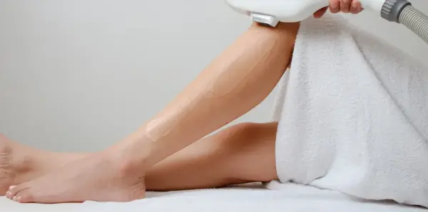 Laser Hair Removal